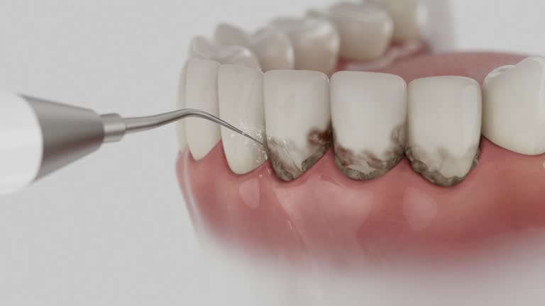 Reliable Dental Implants contractor in Monument Hills, CA by Smile Center Dentistry